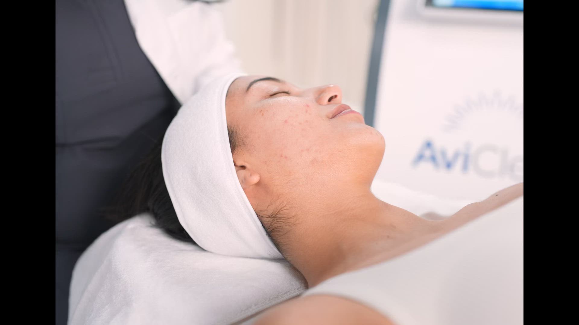 AviClear-Behandlung im Gesicht